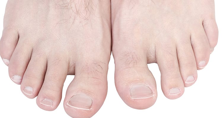 Click here to learn how we treat hallux rigidus