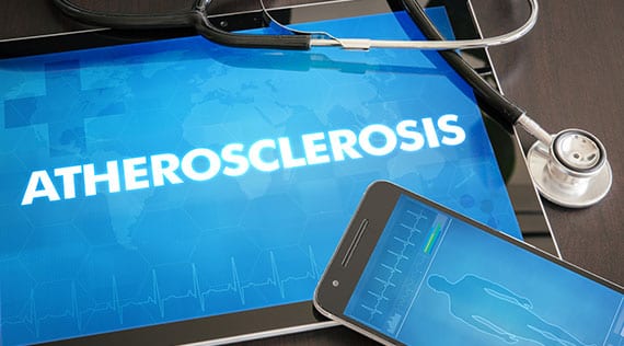 Medical stethoscope and tablet that says atherosclerosis.