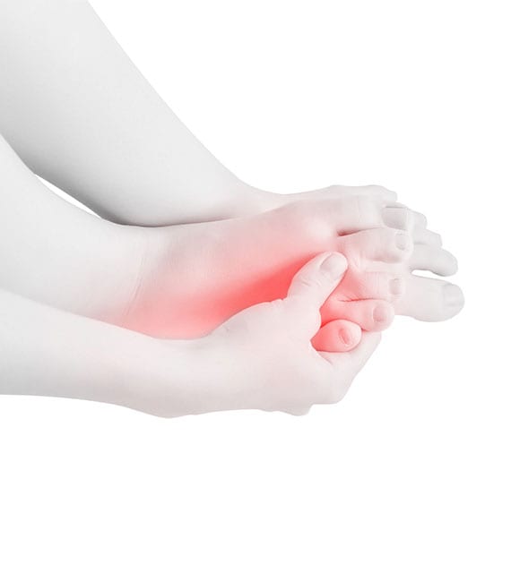 Foot suffering with peripheral neuropathy.
