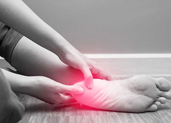 Foot with pain because of plantar fasciitis.