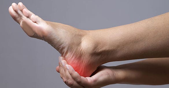 Foot with pressure ulcer at the heel.