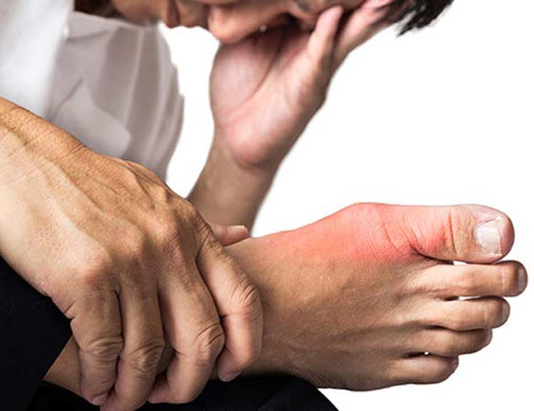Man suffering with foot pain from gout.