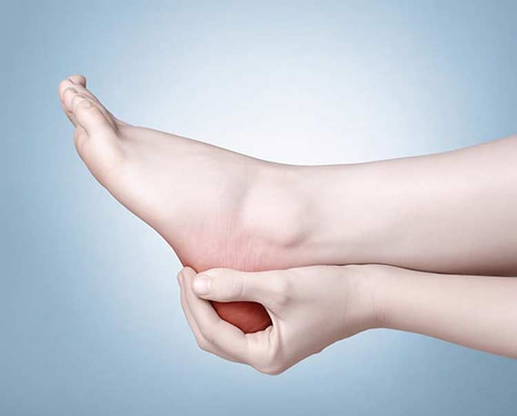 Foot with pain in heel due to Haglund's deformity.