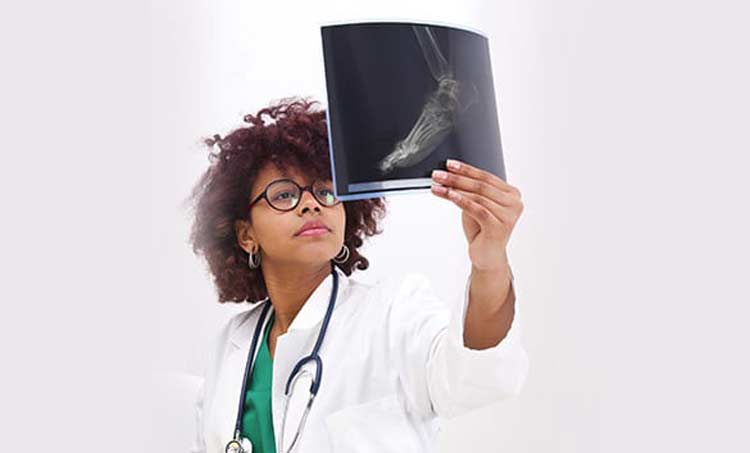 Physician examining x-ray of foot with hammertoe.