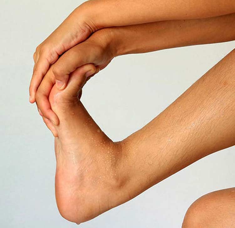 Person holding ball of their foot because of neuroma foot pain.