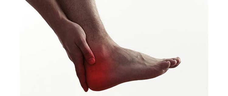 Foot with pain in heel because of peroneal tendon injury.