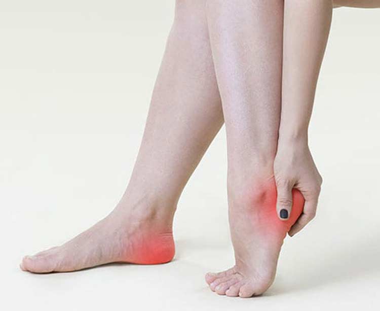 Woman suffering with pressure ulcers on her feet.