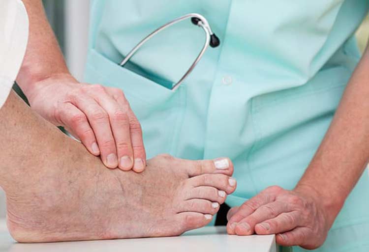 Physician examining a foot in need of TOPAZ treatment.