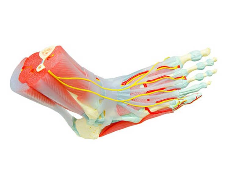 Anatomy of foot with tarsal coalition.