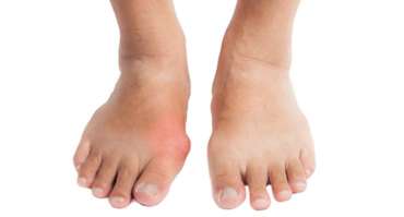Click here to learn more Best Bunion Clinic in Los Angeles