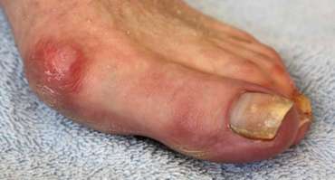 Click here to learn more Best Bunion Specialist in Los Angeles