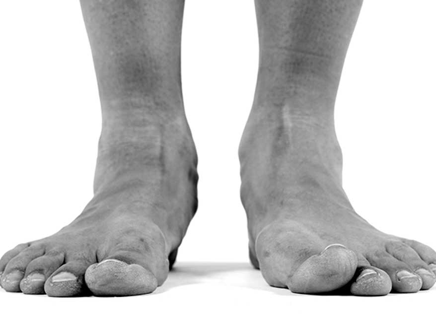 Best-Foot-and-Ankle-Clinic-in-Los-Angeles-LA-Foot-&-Ankle-Center