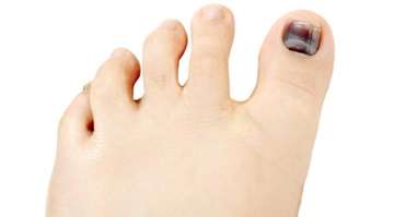 Click here to learn more Best Hammertoe Specialist in Los Angeles